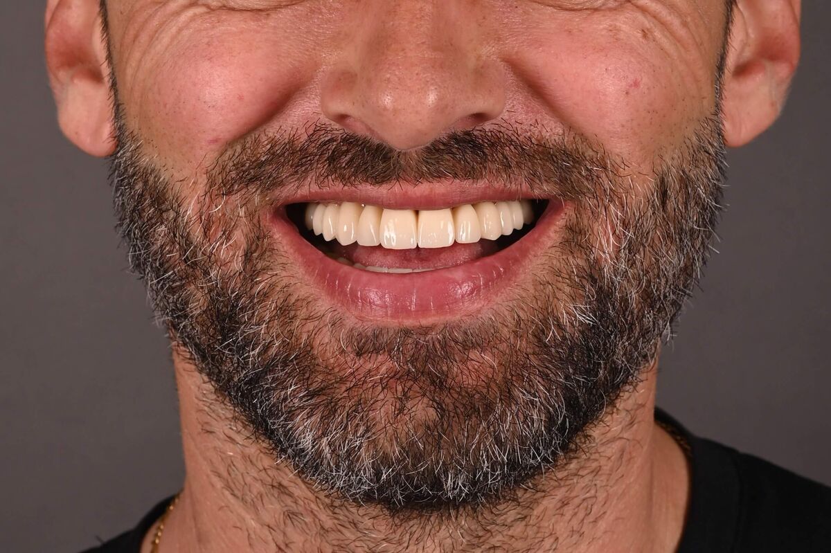 cantaragiu claudiu - dupa